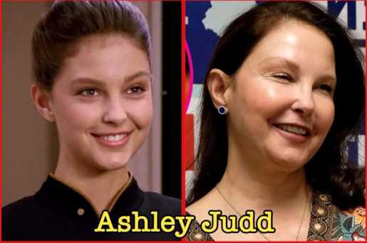 Ashley Judd Face Accident