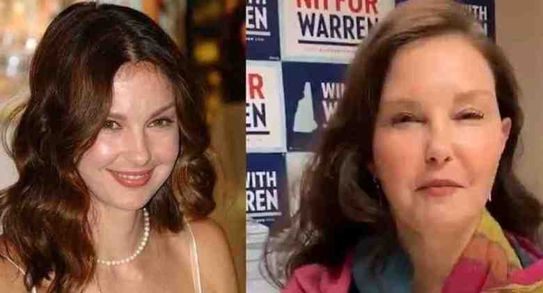Ashley Judd Face Accident