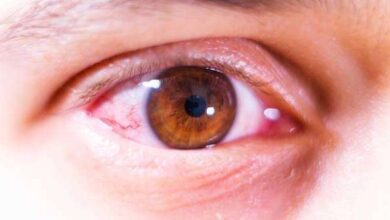 Does Farting Cause Pink Eye