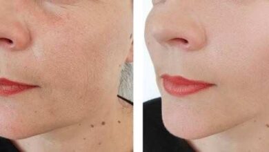 skinpen vs morpheus8